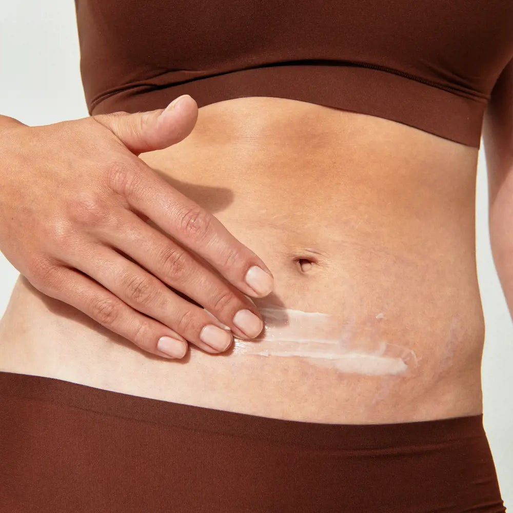 ORIFLAME Anti-Stretch Mark Body Concentrate | Nourishing Care for Smooth, Even Skin-125ml
